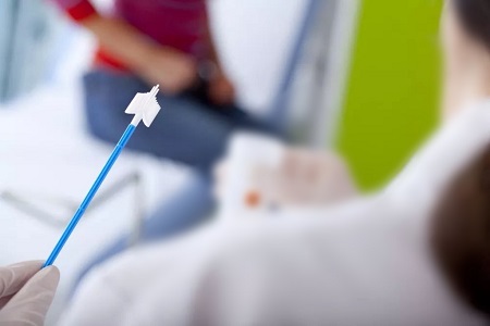 Aholku Cervical Minbiziaren emanaldian aurrerapenak: HPV probak egiteko auto-bildumen eginkizuna