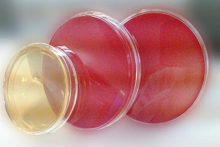 Salmonella Shigella Agar (SS): Patogeno isolamenduaren funtsezko euskarria