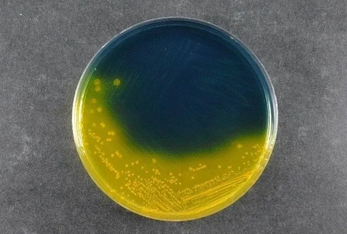 Elikagaien segurtasuna bermatzea: Babioko Salmonella Shigella Agar (SS) patogenoen detekzio estandar globalak onartzen ditu