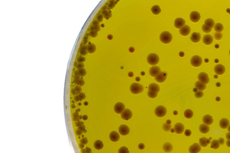 Babiok kalitate handiko Baird-Parker Agar base abian jarri du Staphylococci probak fidagarrietarako