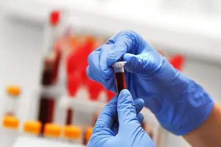 BABIO-k fluoreszentzia behien haurdunaldiaren proba azkarra abiarazten du